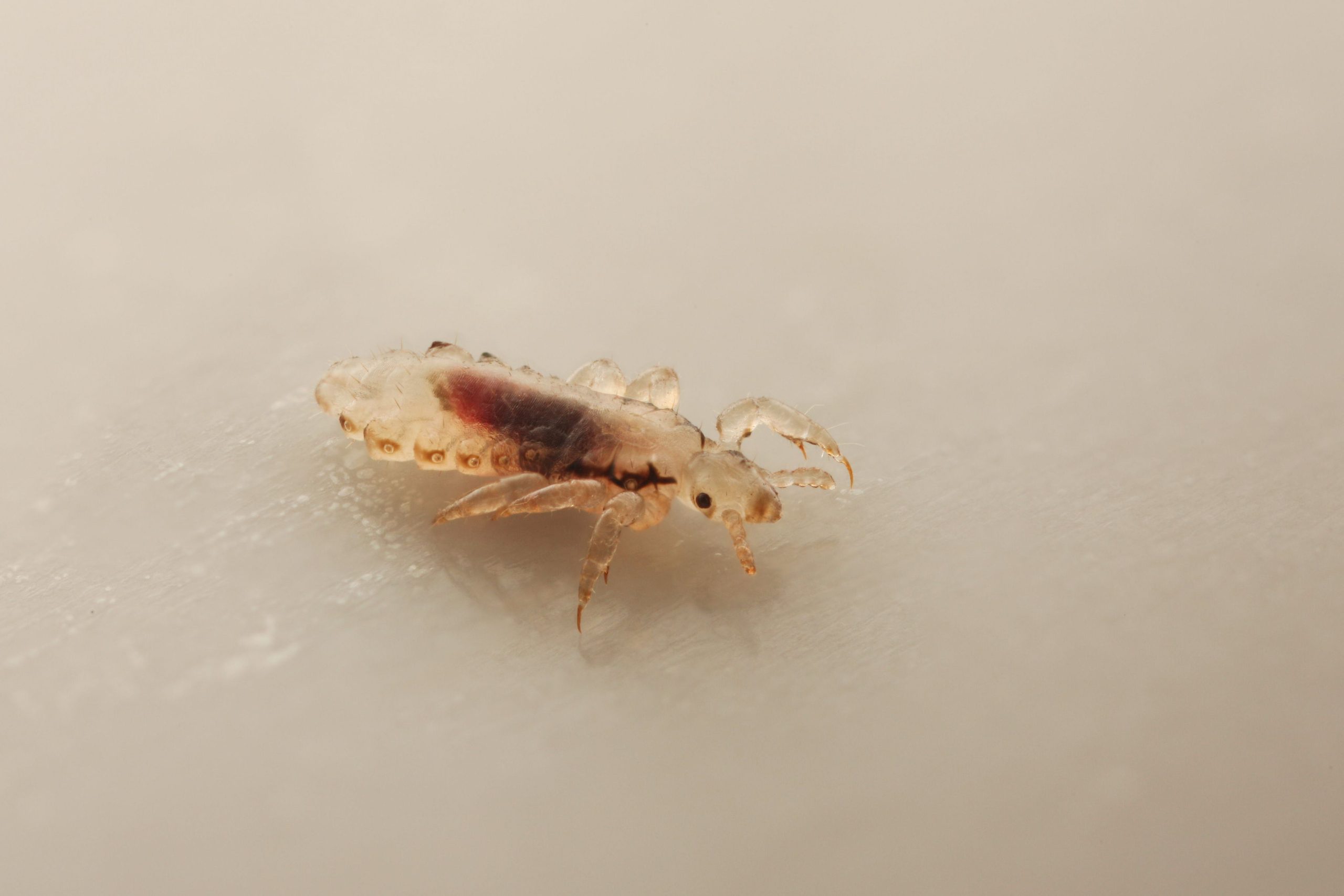 Lice Removal Service: Why You Should Use a Removal Service?